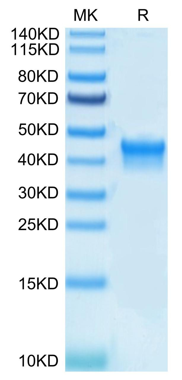Biotinylated Recombinant Human IL-2 R alpha/CD25 Protein (RPCB0529)