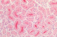 Immunohistochemistry analysis using Rabbit Anti-Tau Polyclonal Antibody (STPA00087). Tissue: Kidney. Species: Human. Fixation: Formalin fixed paraffin-embedded. Primary Antibody: Rabbit Anti-Tau Polyclonal Antibody (STPA00087).
