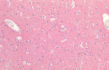 Immunohistochemistry analysis using Rabbit Anti-Tau Polyclonal Antibody (STPA00088). Tissue: Brain Cortex. Species: Human. Fixation: Formalin fixed paraffin-embedded. Primary Antibody: Rabbit Anti-Tau Polyclonal Antibody (STPA00088).