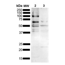 Western blot analysis of Mouse, Rat Brain showing detection of Multiple bands due to different isoforms/aggregation states Tau protein using Rabbit Anti-Tau Polyclonal Antibody (STPA00089). Lane 1: MW Ladder. Lane 2: Mouse brain (15 ug). Lane 2: Rat brain (15 ug). Load: 15 ug. Block: 5% Skim Milk powder in TBST. Primary Antibody: Rabbit Anti-Tau Polyclonal Antibody (STPA00089) at 1:1000 for 2 hours at RT with shaking.