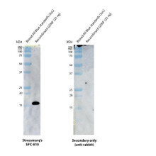 Western blot analysis with anti-GDNF polyclonal antibody (STPA00090) showing detection of human recombinant GDNF protein (SinoBiological 10561-HNAE). This recombinant protein has a predicted molecular weight of 15.2 kDa. Block: 5% skim milk. Primary Antibody: Rabbit Anti-GDNF Polyclonal Antibody (STPA00090) at 1:5000 for 2 hours at RT. Secondary Antibody: Goat anti-rabbit IgG:HRP at 1:5000 for 1 hour at RT.