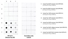 Dot blot analysis comparing detection of Tau isoforms. Of note is that STPA00091 does not bind to 0N or 1N isoforms. Block: 5% skim milk. Primary Antibody: Anti-human Tau 2N3R/4R polyclonal antibody (STPA00091) incubated for 1/2 hour at RT. Secondary Antibody: Goat anti-rabbit IgG:HRP at 1:4000 for 1/2 hour at RT. Color Development: Chemiluminescent for HRP (Moss) for 1 min in RT. Exposed 1 second.