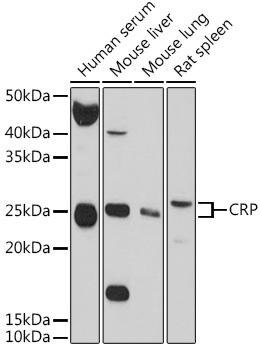 C-Reactive Protein Rabbit Polyclonal Antibody