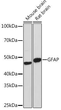 GFAP Rabbit Polyclonal Antibody