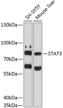 STAT3 Rabbit Polyclonal Antibody