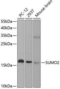 Signal Transduction Antibodies 2 Anti-SUMO2 Antibody CAB2571