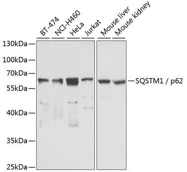 SQSTM1 / p62 Rabbit Polyclonal Antibody