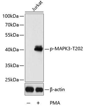 Phospho-ERK1 (T202) Antibody