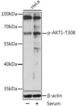 Phospho-AKT1 (T308) Antibody