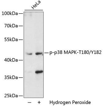 Phospho-p38 MAPK (Thr180/Tyr182) Antibody