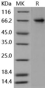Human PTGS2/COX2/PGHS-2 Recombinant Protein (His Tag) (RPES0411)