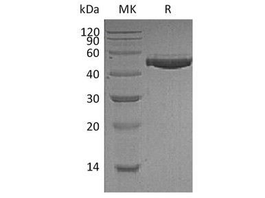 Human Complement Factor H/CFH Recombinant Protein (His Tag) (RPES0915)