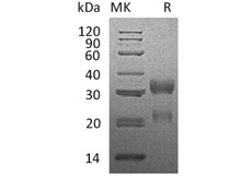 Human CGA&CGB3 Heterodimer Recombinant Protein (RPES2451)