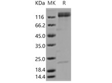 Human ITGA5 & ITGB1 Heterodimer Recombinant Protein (RPES2879)