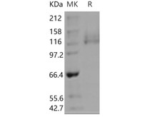 Human ITGA6 & ITGB1 Heterodimer Recombinant Protein (RPES2900)