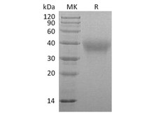 Marmoset TIM-3/HAVCR2 Recombinant Protein (RPES3597)