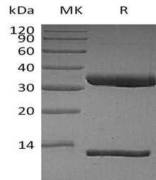 Human FcRn & B2M Heterodimer Recombinant Protein (RPES3629)