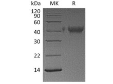 Human TIM-3/HAVCR2 Recombinant Protein (RPES4563)