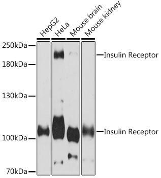 Insulin Receptor Antibody Human,Mouse,Rat Assay Genie