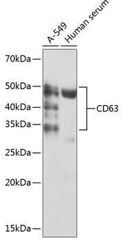 PIG / CD8枚セット CD63 Monoclonal Antibody (CAB19023)