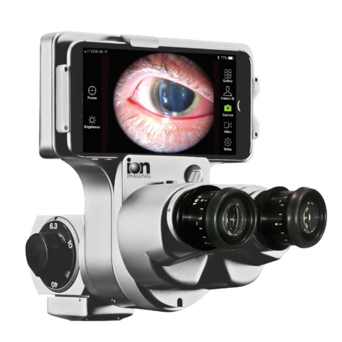 Sistema de video Marco ION