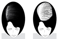 Choose the Perfect Hair Topper in 3 Easy Steps Choose the Perfect Hair Topper in 3 Easy Steps