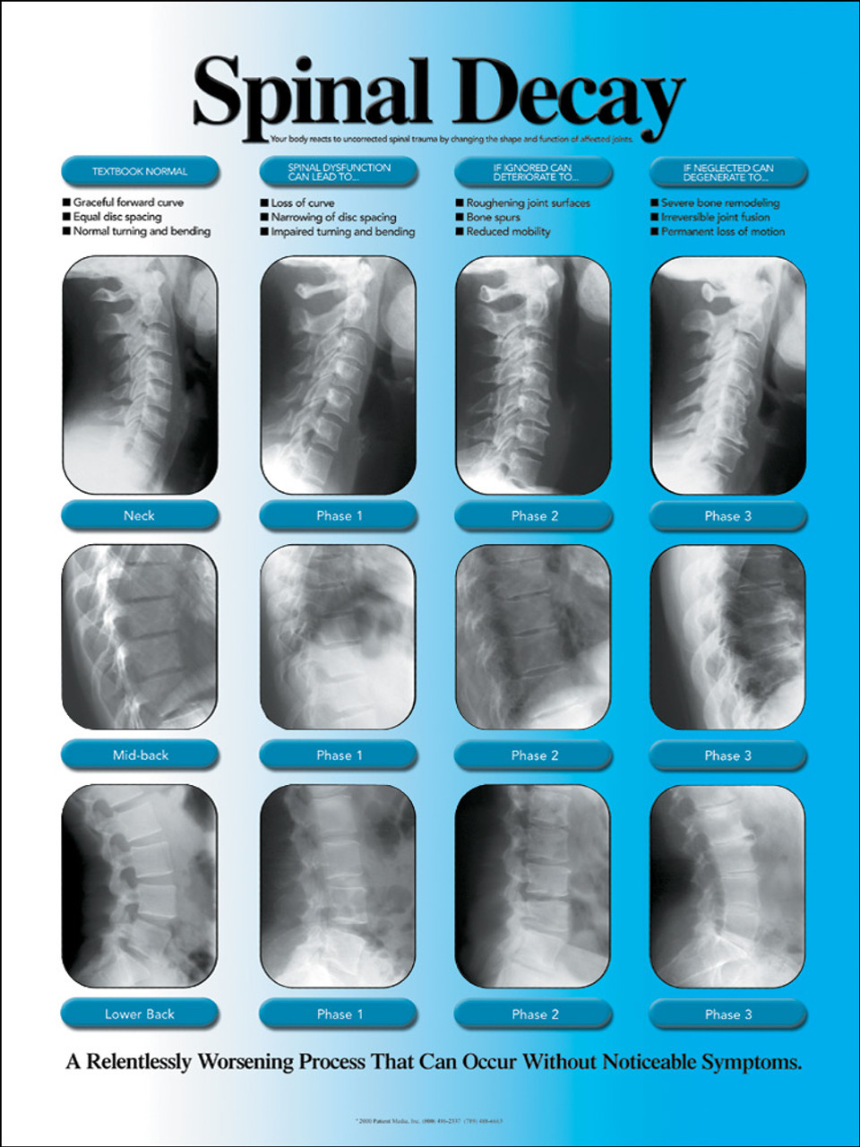 Chiropractic Spine Chart