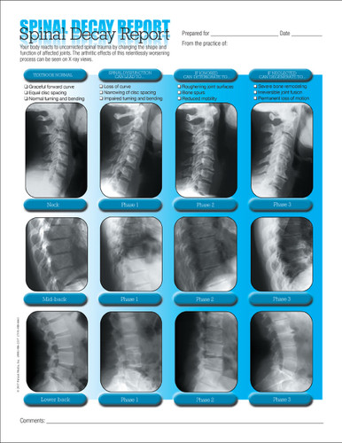 Right-facing X-rays to match your technique.