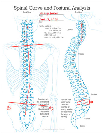 Posture 101 - The Correct Posture - Mariska Odendaal Physiotherapy