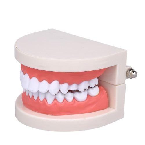 [通拓商品]Standard Tooth Teaching Giant Dental Dentist Teeth Model Child Kidtraining Model Disease Teeth Medical Educational Model