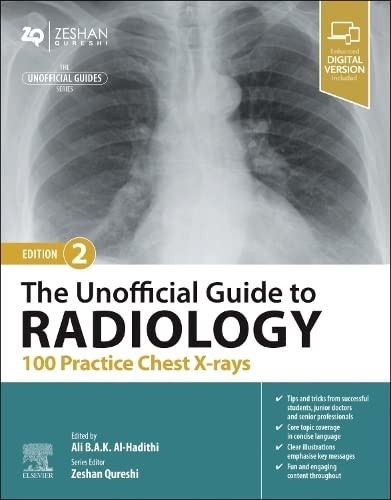 The Unofficial Guide to Radiology: 100 Practice Chest X-rays (Unofficial Guides)