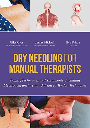 Dry Needling for Manual Therapists: Points, Techniques and Treatments, Including Electroacupuncture and Advanced...