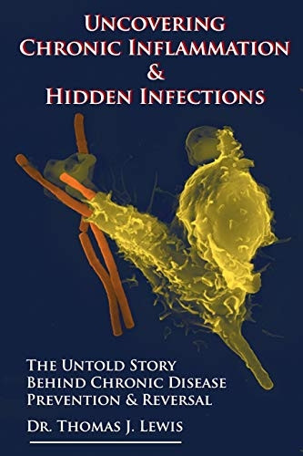 Uncovering Chronic Inflammation & Hidden Infections: The Untold Story Behind Chronic Disease Prevention & Reversal