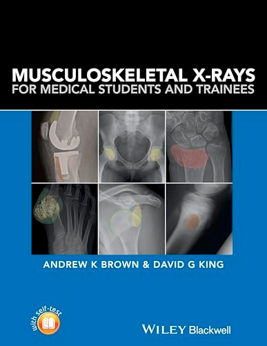 Musculoskeletal X-Rays for Medical Students and Trainees