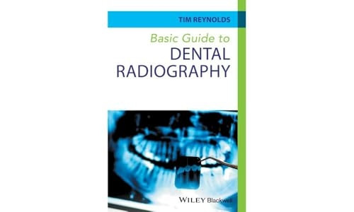 Basic Guide to Dental Radiography (Basic Guide Dentistry Series)