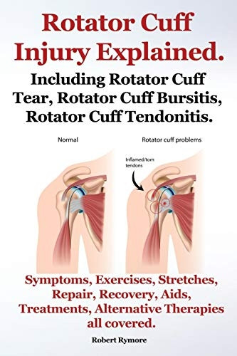 Rotator Cuff Injury  - Explained. Including Rotator -  Cuff Tear, Rotator Cuff  - Bursitis, Rotator Cuff  - Tendonitis. Symptoms,  - Exercises, Stretches,  - Repair, Recovery, Aids,  - Treatments, Alternative  - Therapies all covered.