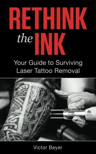 Rethink the Ink: Your Guide to Surviving Laser Tattoo Removal