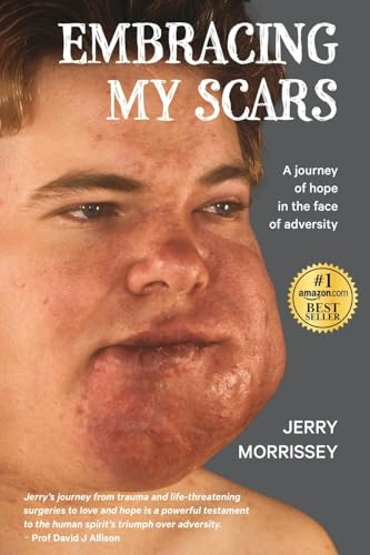Embracing My Scars: A journey of hope in the face of adversity