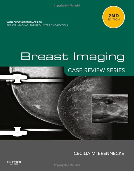 Breast Imaging: Case Review Series, 2e