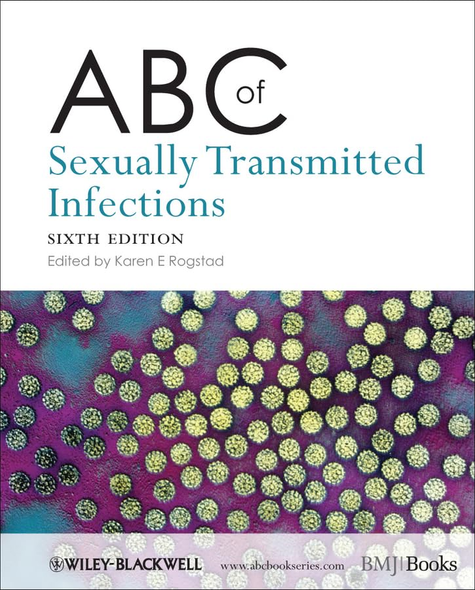 ABC of Sexually Transmitted Infections (ABC Series)