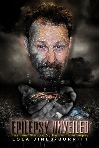 Epilepsy Unveiled
