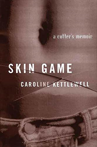 Skin Game: A Memoir