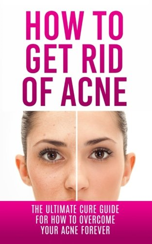 How to Get Rid of Acne: The Ultimate Cure Guide for How to Overcome Your Acne Forever (Acne Cure, Acne Treatment, Acne No More, Acne Diet, How to Get Rid of Pimples, Back Acne)