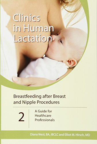 Breastfeeding after Breast and Nipple Procedures: A Guide for Healthcare Professionals: Volume 2 (Clinics In Human...