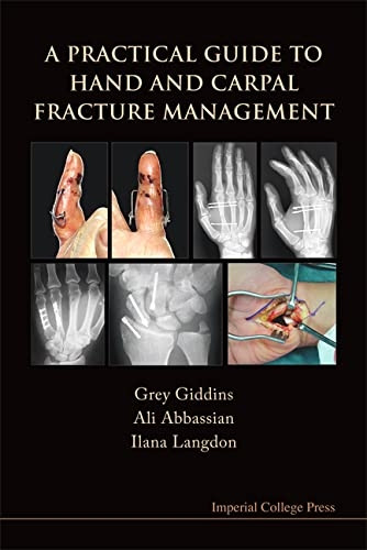 A PRACTICAL GUIDE TO HAND AND CARPAL FRACTURE MANAGEMENT