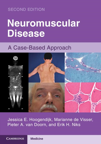 Neuromuscular Disease: A  Case-Based Approach
