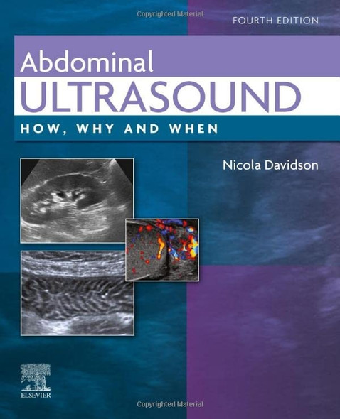 Abdominal Ultrasound: How, Why and When (How, Why and When)
