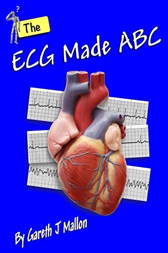 The ECG Made ABC