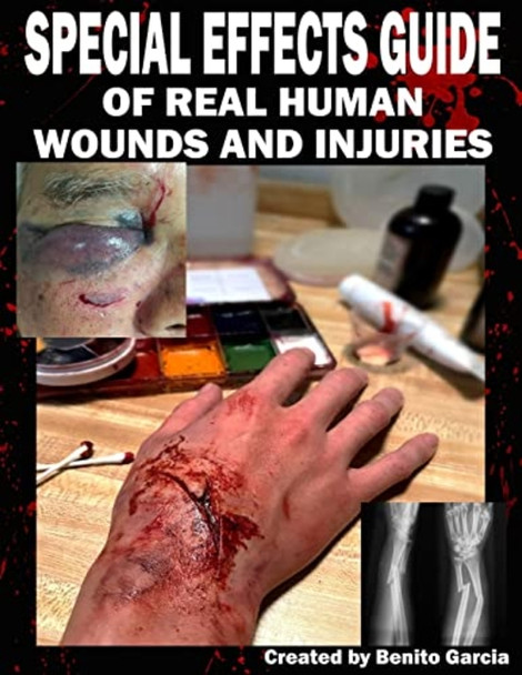 Special Effects Guide of RealHuman Wounds and Injuries:Special Effects Guide of RealHuman Wounds and Injuries
