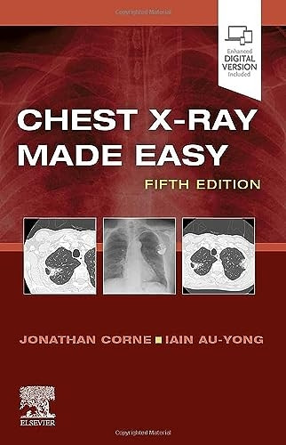 Chest X-Ray Made Easy (Made Easy)